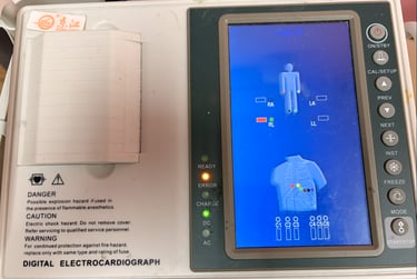 Bacaan graf ECG