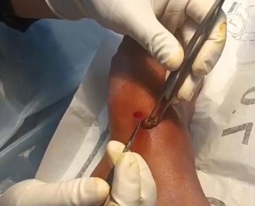 Bilik prosedur pembedahan kecil Klinik Raudhah