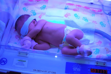 Ujian bilirubin bayi di klinik